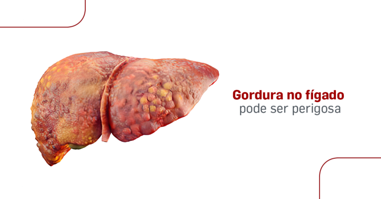 gordura no figado